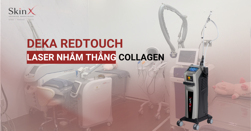 RedTouch 675 nm: Công nghệ collagen chọn lọc dành riêng cho da châu Á